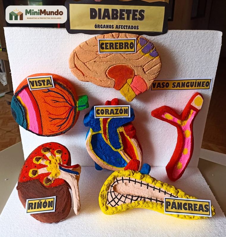 Maqueta: Diabetes: órganos afectados. Cerebro, vista, corazón, vasos sanguíneos, riñón y páncreas.